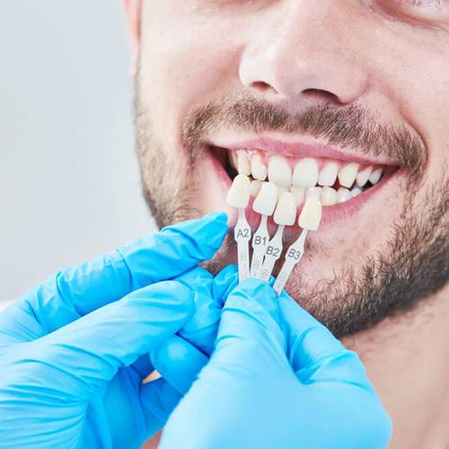 general dentistry benchmark dental windsor co services veneers image