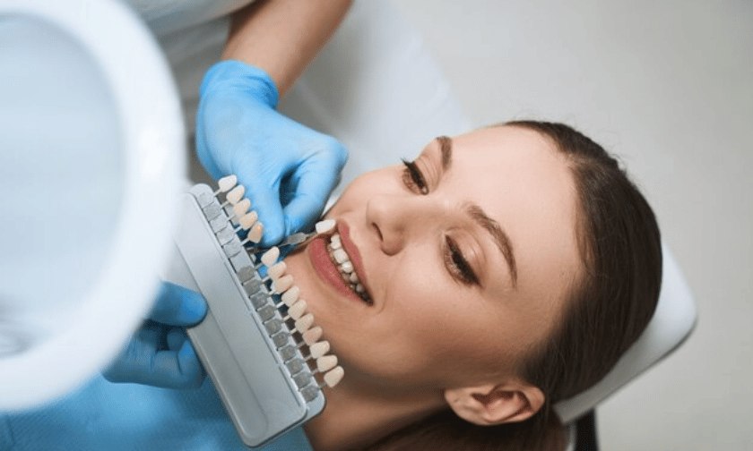 Tips To Care For Your Dental Veneers