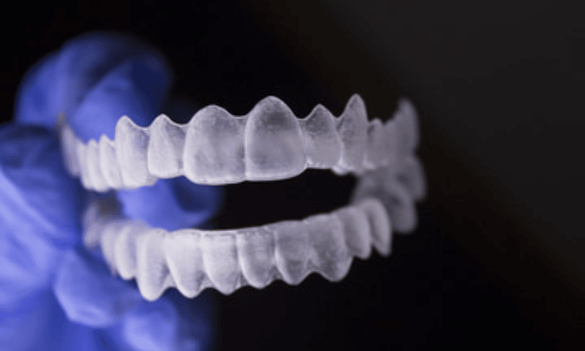 Factors that determine if Invisalign is right for you.