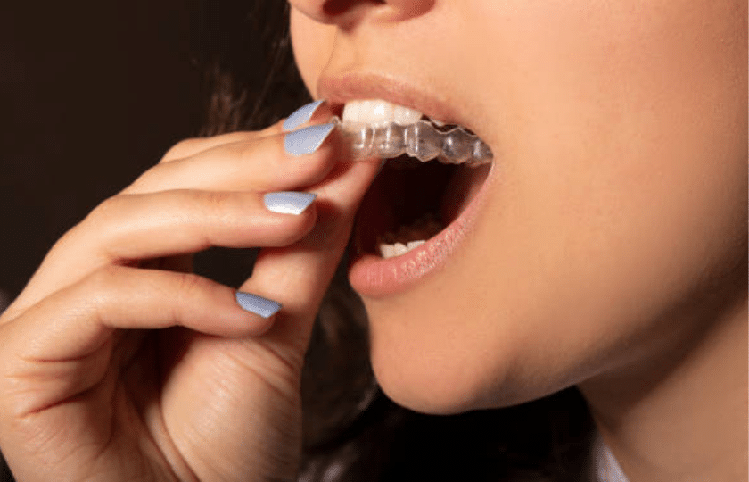 Invisalign Firestone Invisalign Firestone