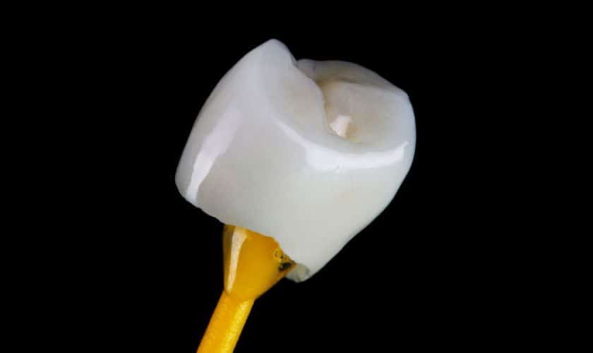 Caring for Your Dental Crowns: Tips for Long-Term Maintenance