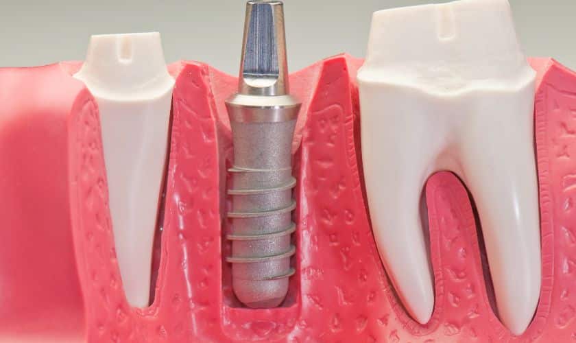 Emergency Dentist in Windsor Emergency Dentist in Windsor