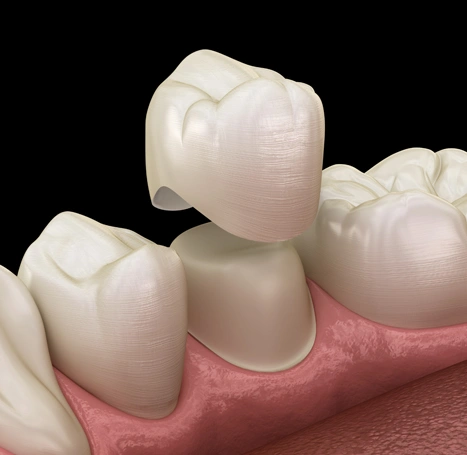 general dentistry benchmark dental windsor co dr josh Fowler image
