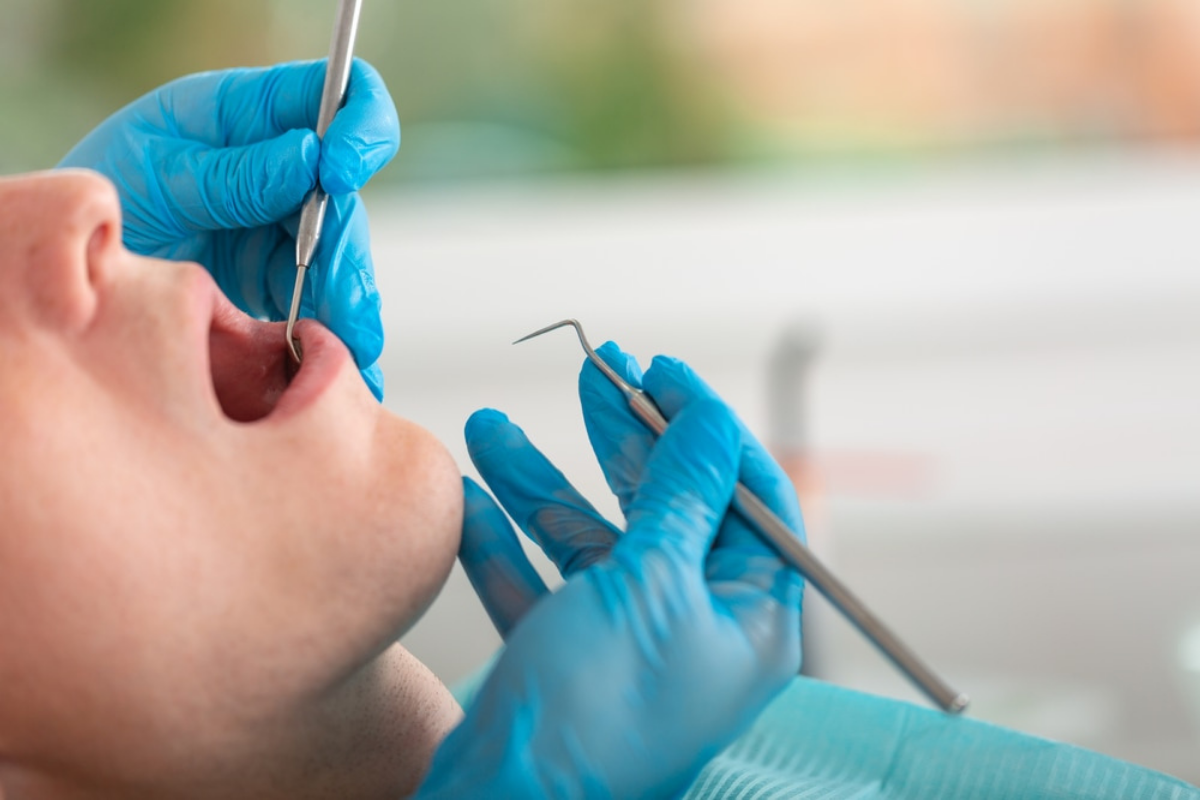 How Long Does a Filling Take? Insights Shared by Our Dentist in Firestone How Long Does a Filling Take? Insights Shared by Our Dentist in Firestone