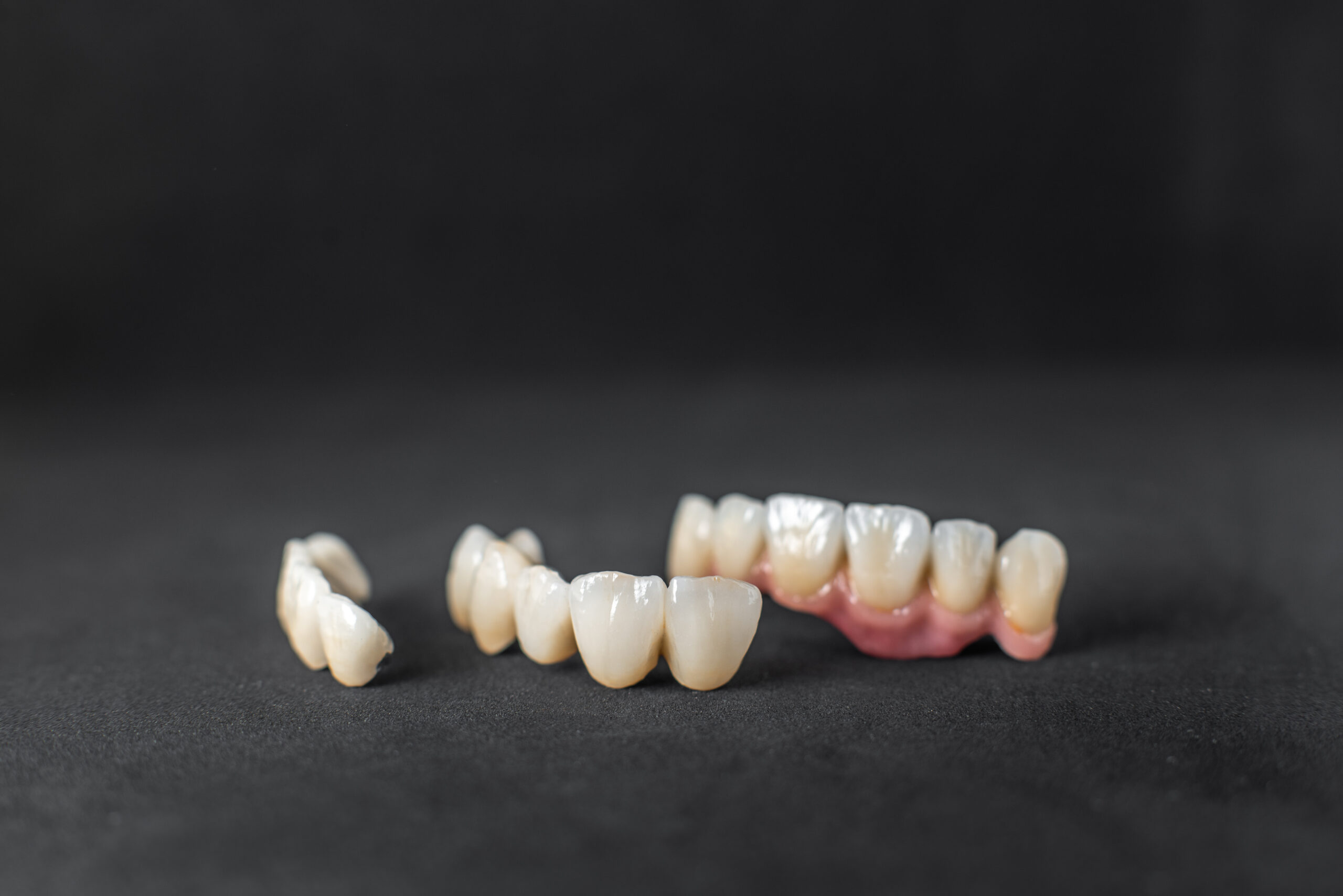 Dental crowns on the black background Dental crowns and a dental bridge displayed on a dark background, illustrating restorative tooth protection options