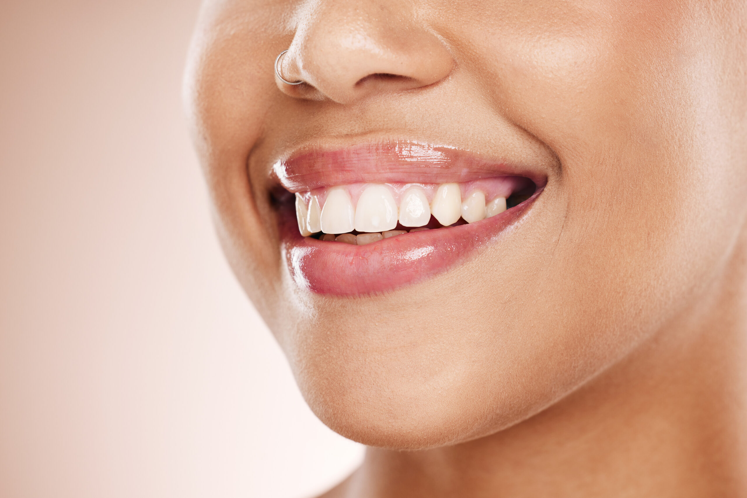 dental-teeth-and-beauty-with-smile-of-woman-for-p-2025-04-06-08-23-28-utc (3) Close-up of a healthy natural smile showing smooth front teeth after cosmetic dental improvement