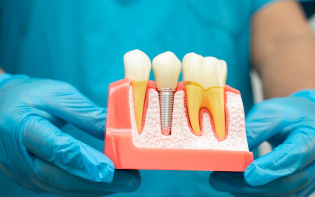 7 Warning Signs Your Tooth May Need a Crown